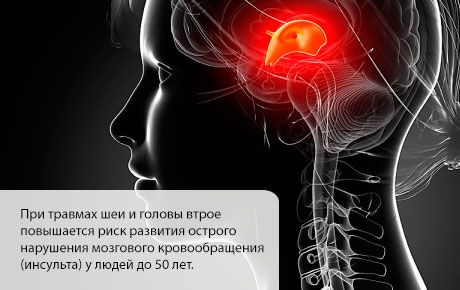 Ризик од можданог удара повећава се у првим месецима након повреде главе или врата